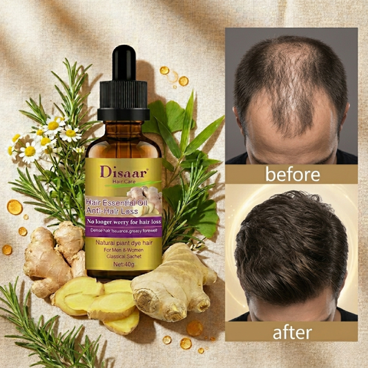 GingerGrow™ – Aceite Esencial Anticaída con Jengibre Natural | Estimula el Crecimiento Capilar en Hombres y Mujeres
